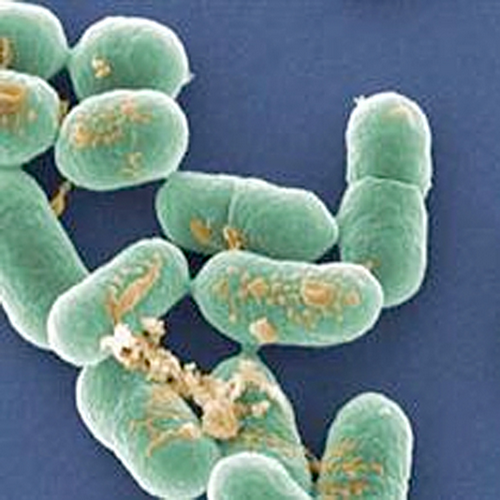 Gejala Listeria monocytogenes berbahaya, karena organisme yang